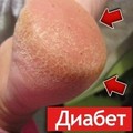 Натуральное "волшебное" средство от диабета!