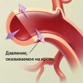 Высокое давление. Мы поможем Вам решить проблему...