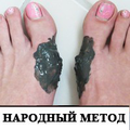 Воспаленная КОСТОЧКА сдуется вмиг